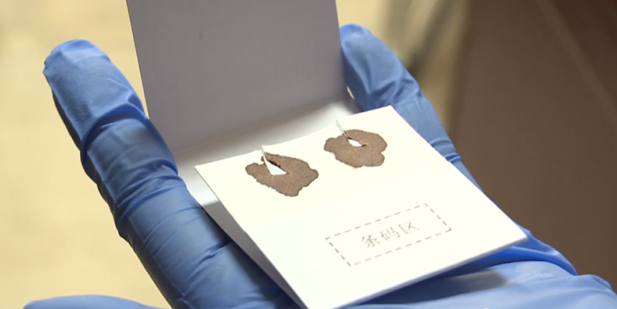 乐山医院办理亲子鉴定所需的样本有什么,